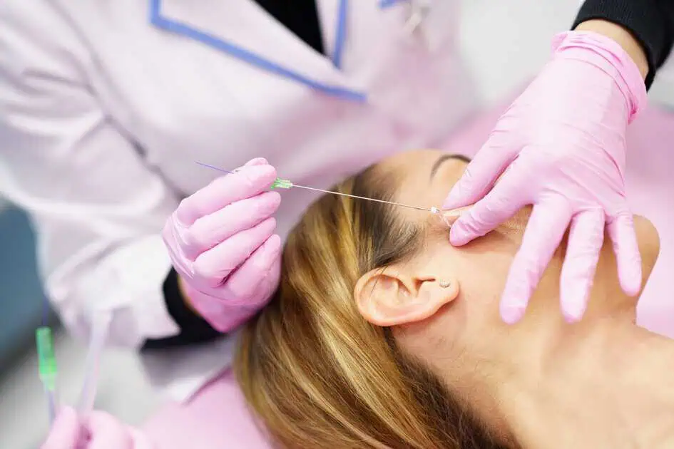PDO Thread Lifts Treatment in San Francisco, CA by Selfishly Aesthetics & Wellness