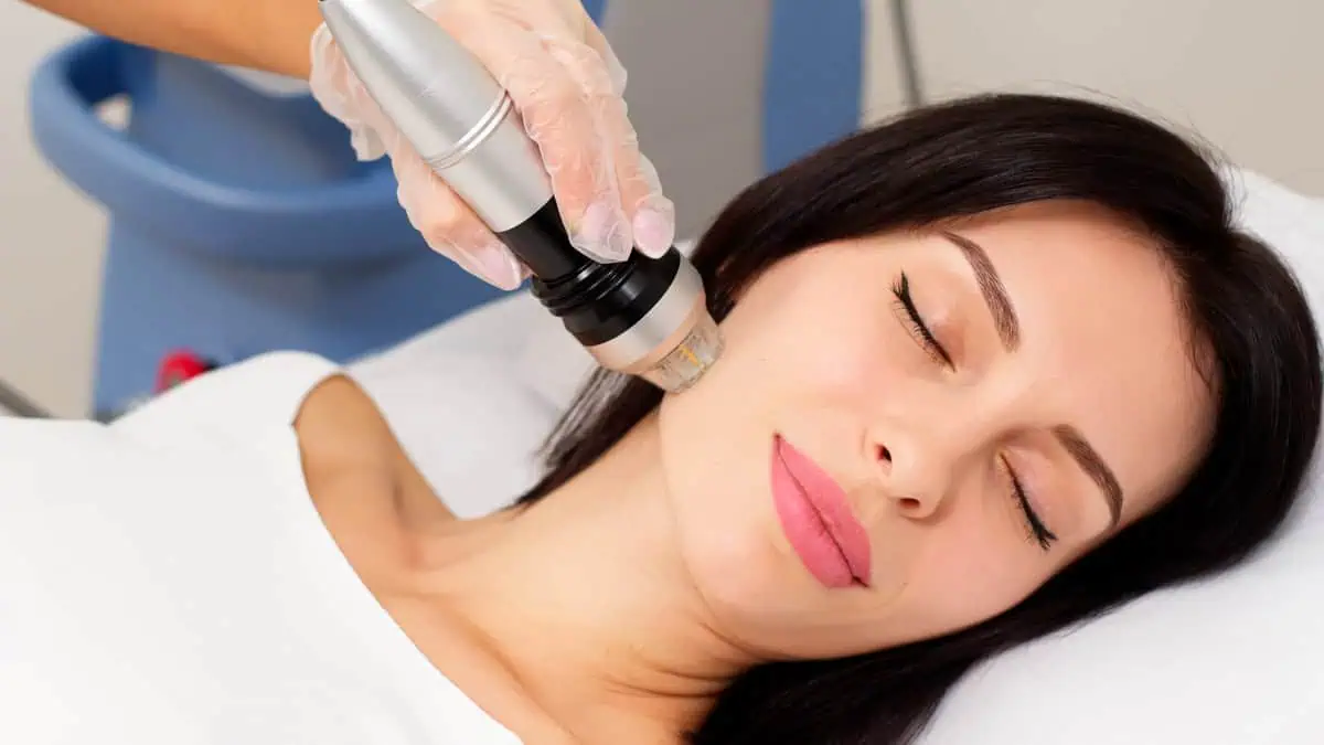 woman receiving morpheus8 rf microneedling skin tightening treatment in San Francisco CA